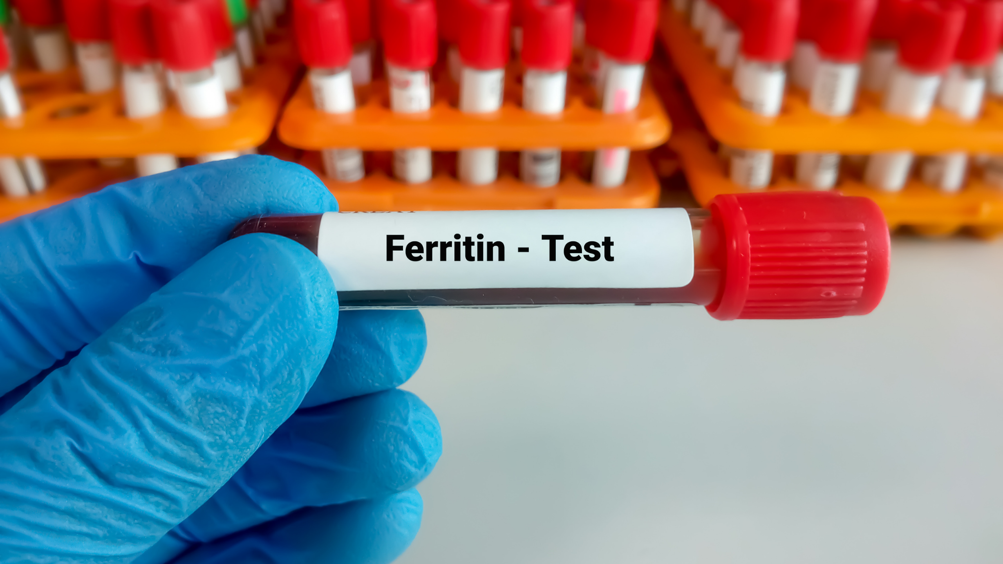 Comprendre le Bilan Martial : Quand S'inquiéter de ses Taux de Ferritine ?
